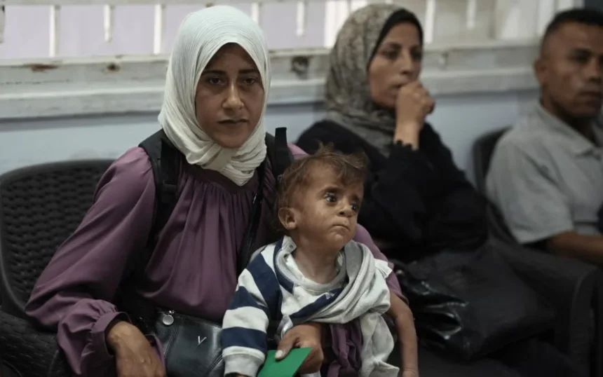 The devastating impact of Israels manufactured malnutrition crisis in Gaza